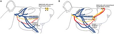 Muscle-Nerve-Nerve Grafting Improves Facial Reanimation in Rats Following Facial Nerve Injury